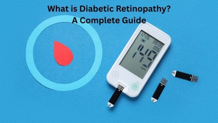 What is Diabetic Retinopathy? A Complete Guide