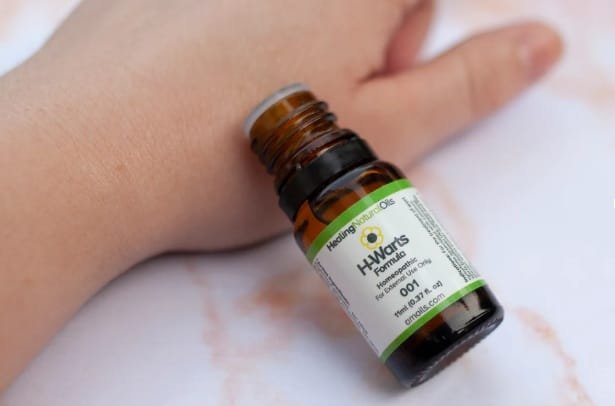 Best Products and Methods to Remove Warts